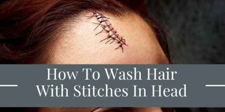 How To Wash Hair With Stitches In Head