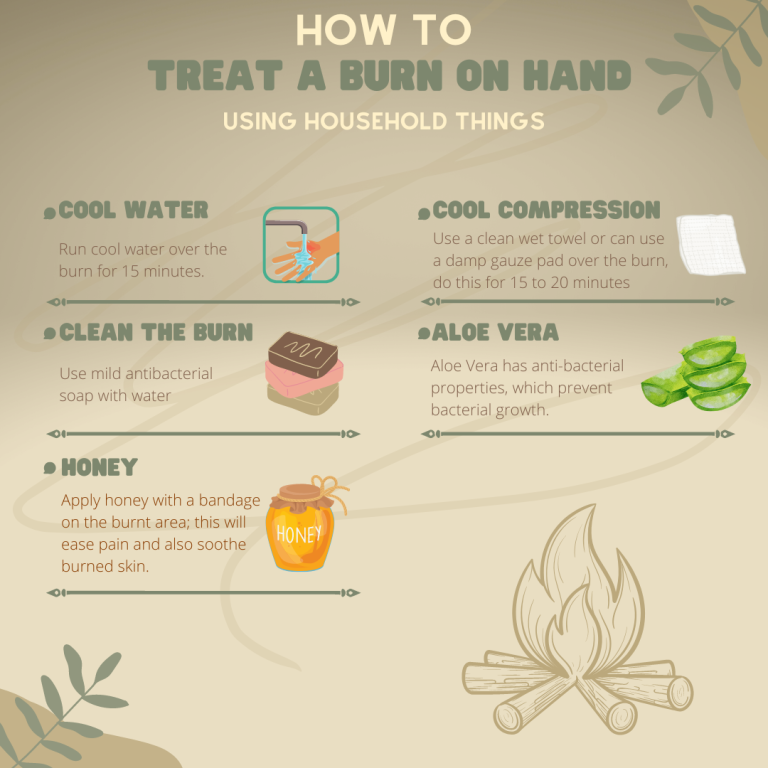How to Treat a Burn on Hand From Hot Pan Using Household Things